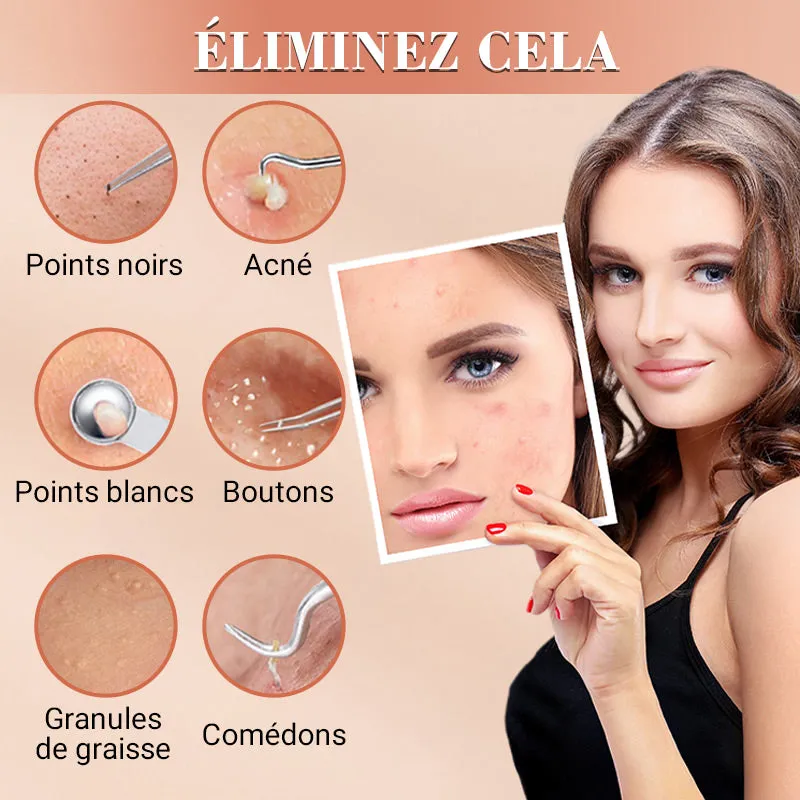  50% discount  Blackhead and Button Extraction Toolkit