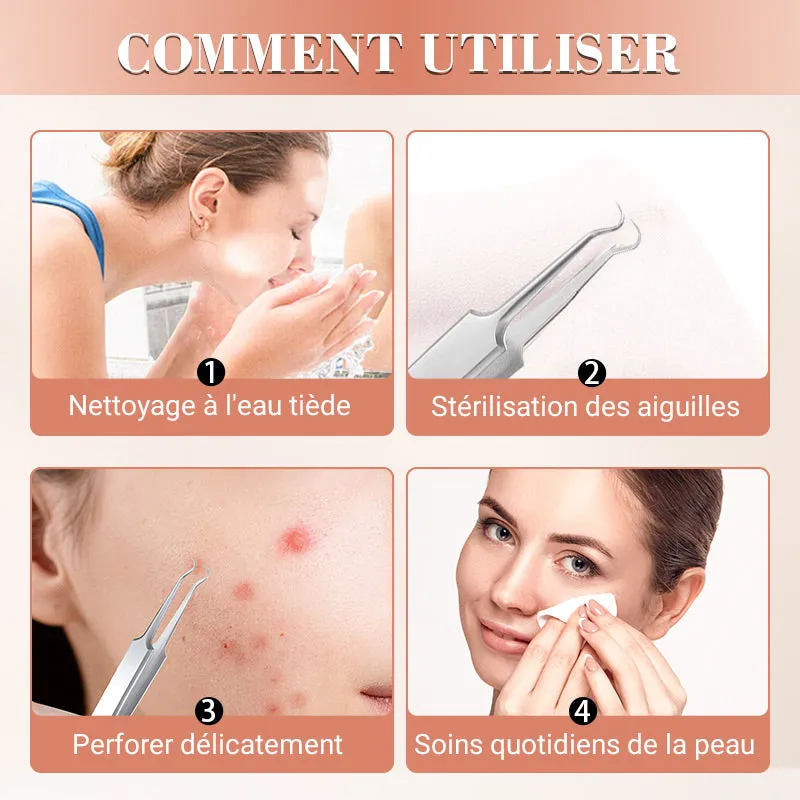  50% discount  Blackhead and Button Extraction Toolkit